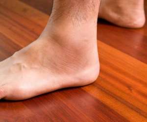 علت ، عوارض و درمان کف پای صاف