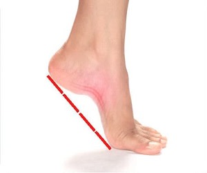 از کف پای صاف تا گودی کمر