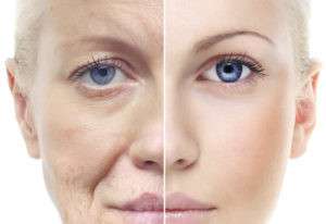 چین و چروک صورت به چه معناست و چگونه میتوانیم از آن جلوگیری کنیم؟ 