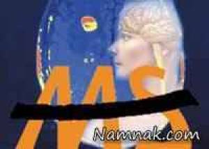 علائمی که میتواند نشانه ام اس باشد