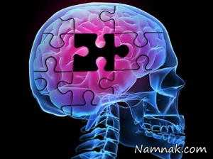 آلزایمر و عوارض و علائم آن