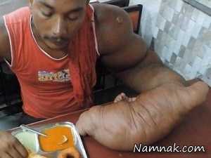 پسر جوان با دست غول پیکر 20 کیلوگرمی