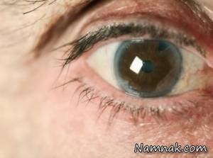 اصلی ترین عوامل ایجاد آب سیاه