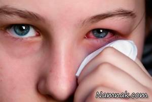 علت ورم بهاره چشم چیست؟
