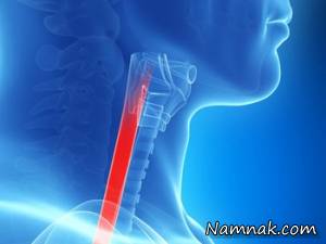 همه چیز درباره سرطان مری (Esophageal cancer) از علائم تا راههای درمان و پیشگیری
