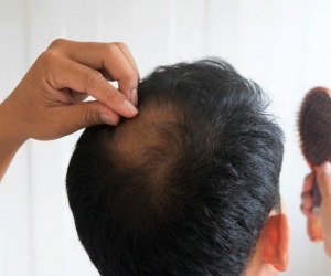 تمام دلایل اصلی و مهم توقف رشد موهایتان