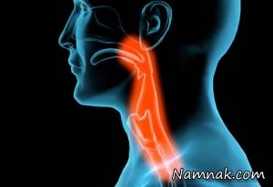دلایل و علائم ابتلا به سرطان سر و گردن
