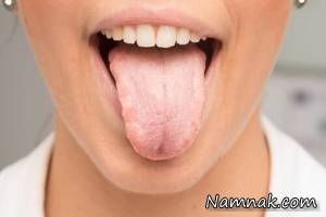 بهترین درمان های خانگی و گیاهی برای رفع سفیدی زبان&nbsp;