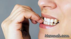 راه کارهای جدید برای ترک عادت جویدن ناخن