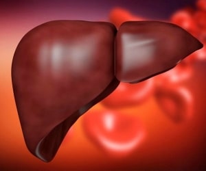 راههای پیشگیری و جلوگیری از ابتلا بیماری کبد چرب (NAFLD)