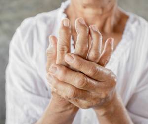 آرتریت روماتوئید چیست و چگونه ایجاد می شود؟