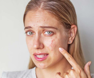 جوش ها چه چیزی را پیرامون سلامت بدن نشان می دهند