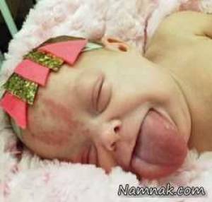دختربچه ای با زبان خیلی بزرگ:
