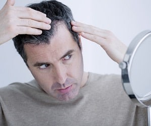 ریزش مو بعد از عمل لاغری