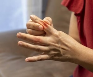 بررسی تمام علل و دلایل ورم انگشتان دست و پا