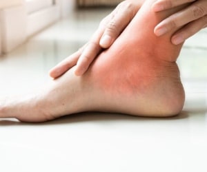 تکنیک فوق&zwnj;العاده رفع خستگی پا مثل آب خوردن