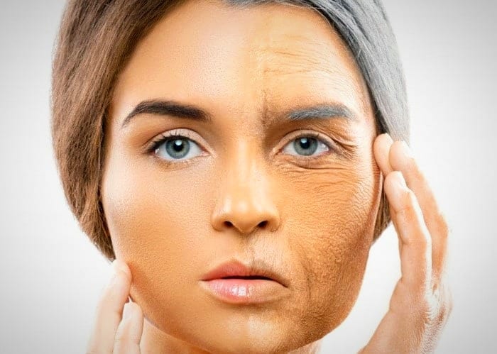 پیری زودرس پوست