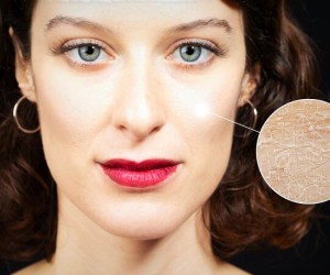 چند پیشنهاد برای مراقبت از پوست چرب و خشک