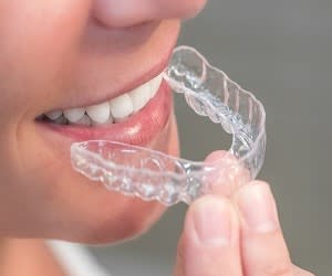 هزینه ارتودنسی نامرئی چقدر است؟