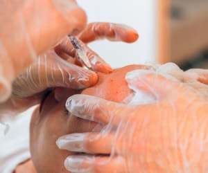 همه چیز درباره مزوبوتاکس چشم، پیشانی و دیگر قسمت های صورت