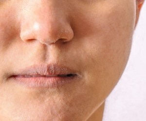 علت خشکی لب ها چیست؟