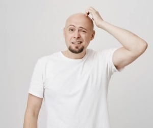 فواید&nbsp; کچل بودن و کم پشتی موها شگفت انگیز است