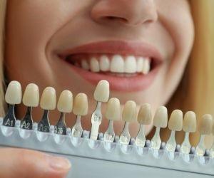 5 دلیل برای خرید مواد دندانپزشکی بصورت آنلاین
