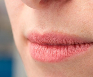 ترک خوردن لب چه دلیل و درمانی دارد؟