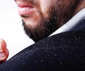 چرا سر من شوره می&zwnj;زند؟
