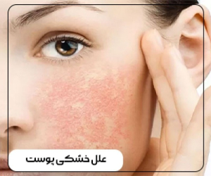 نشانه خشکی پوست چیست؟