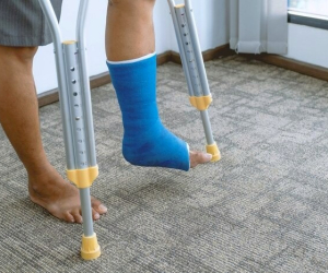 مراقب از پای گچ گرفته در هنگام خواب، استحمام و راه رفتن