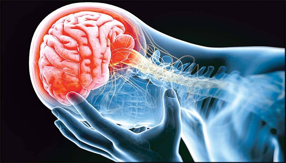 چند راهکار ساده برای پیشگیری از سکته مغزی