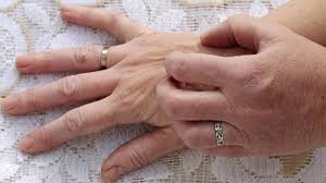 ۴ استراتژی خودمراقبتی برای محافظت از ابتلا به اگزما