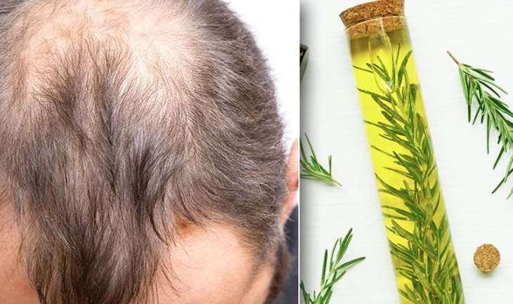 ترفندهایی جادویی برای متوقف سازی ریزش موها
