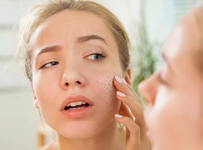 چه زمانی برای خشکی پوست شدید به متخصص پوست مراجعه کنیم؟