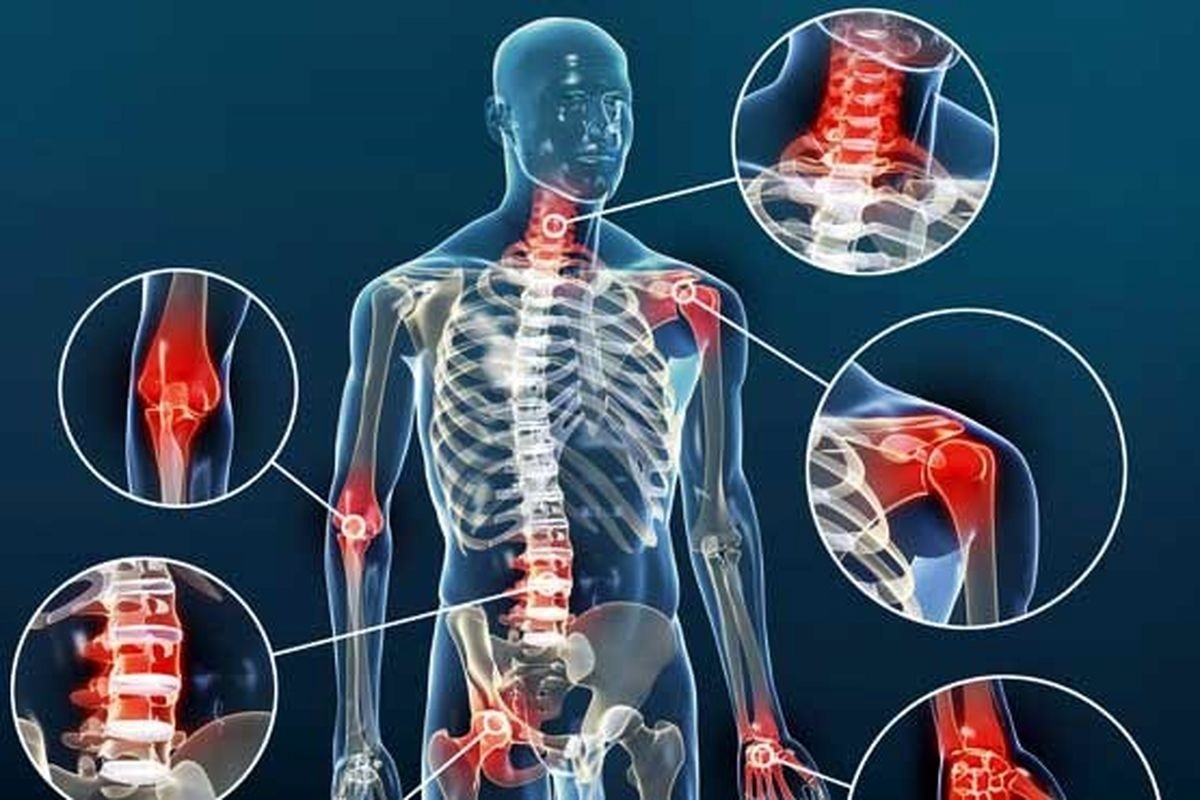 5 نکته هوشمندانه برای مقابله با درد آرتروز