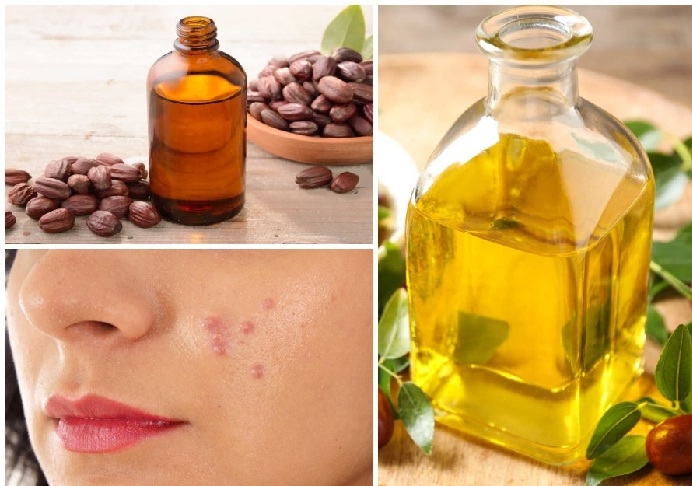 روغن جوجوبا و تاثیر آن بر آکنه و دیگر مشکلات پوستی