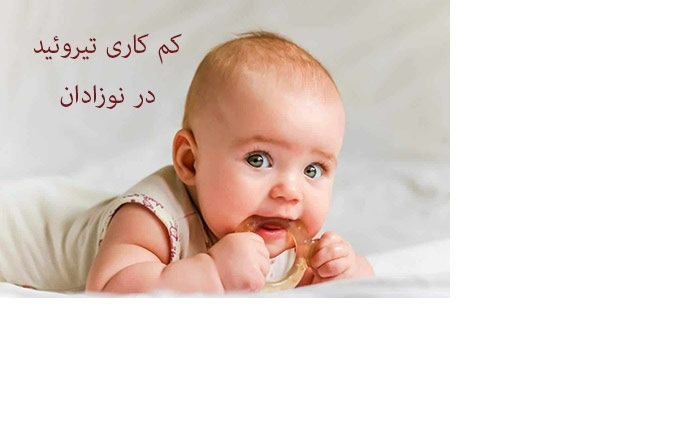 کم‌کاری تیروئید مادرزادی در نوزادان