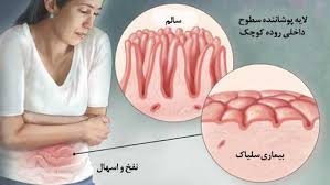 علامت‌های شگفت‌انگیز بیماری سلیاک