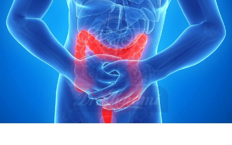 نکاتی برای یادگیری دوست داشتن بدن پس از تشخیص بیماری التهابی روده (IBD)