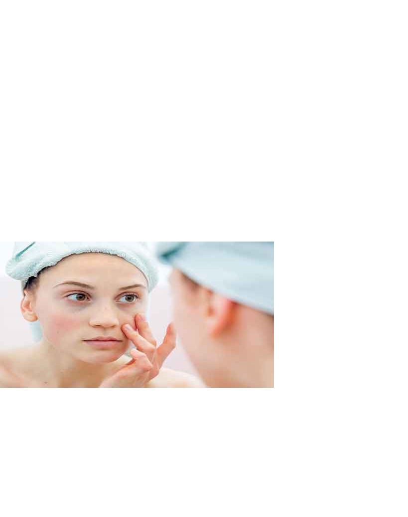 آرتریت پسوریاتیک یا لوپوس؟