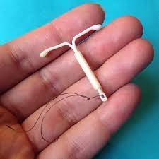 انتظارات هنگام برداشتن IUD
