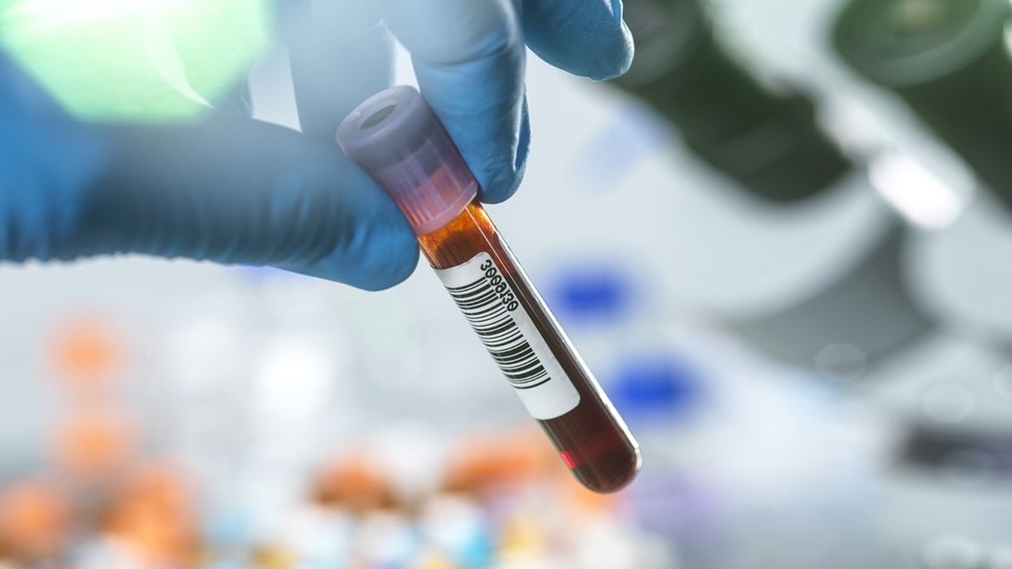 برخی از علائم هشداردهنده اولیه آلزایمر ممکن است در سی سالگی شما ظاهر شود