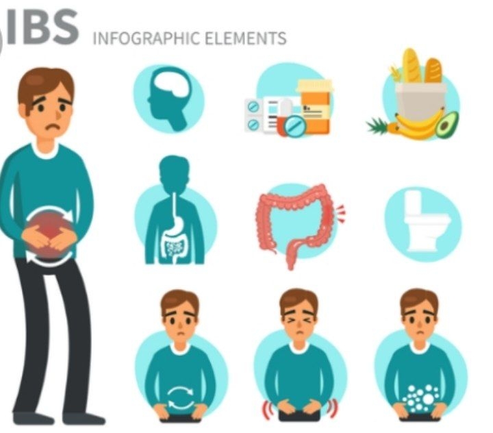 سندروم روده تحریک‌پذیر(IBS) چیست؟