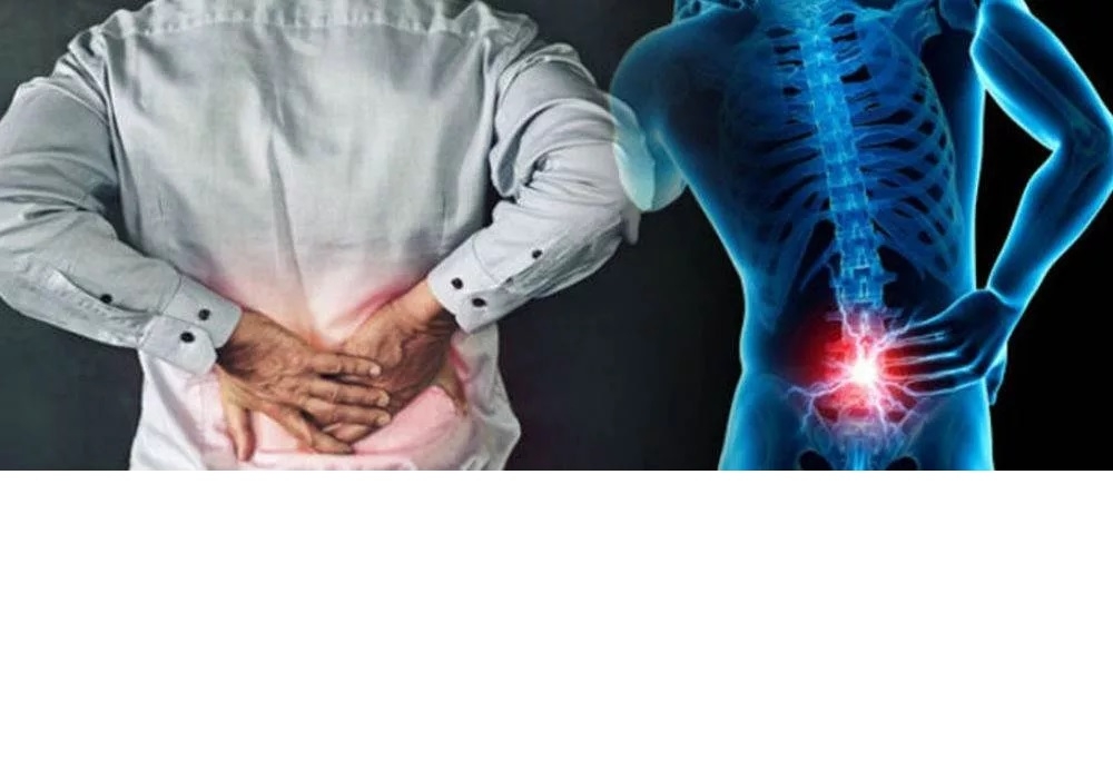 با این نکات کمردرد التهابی را به حداقل برسانید
