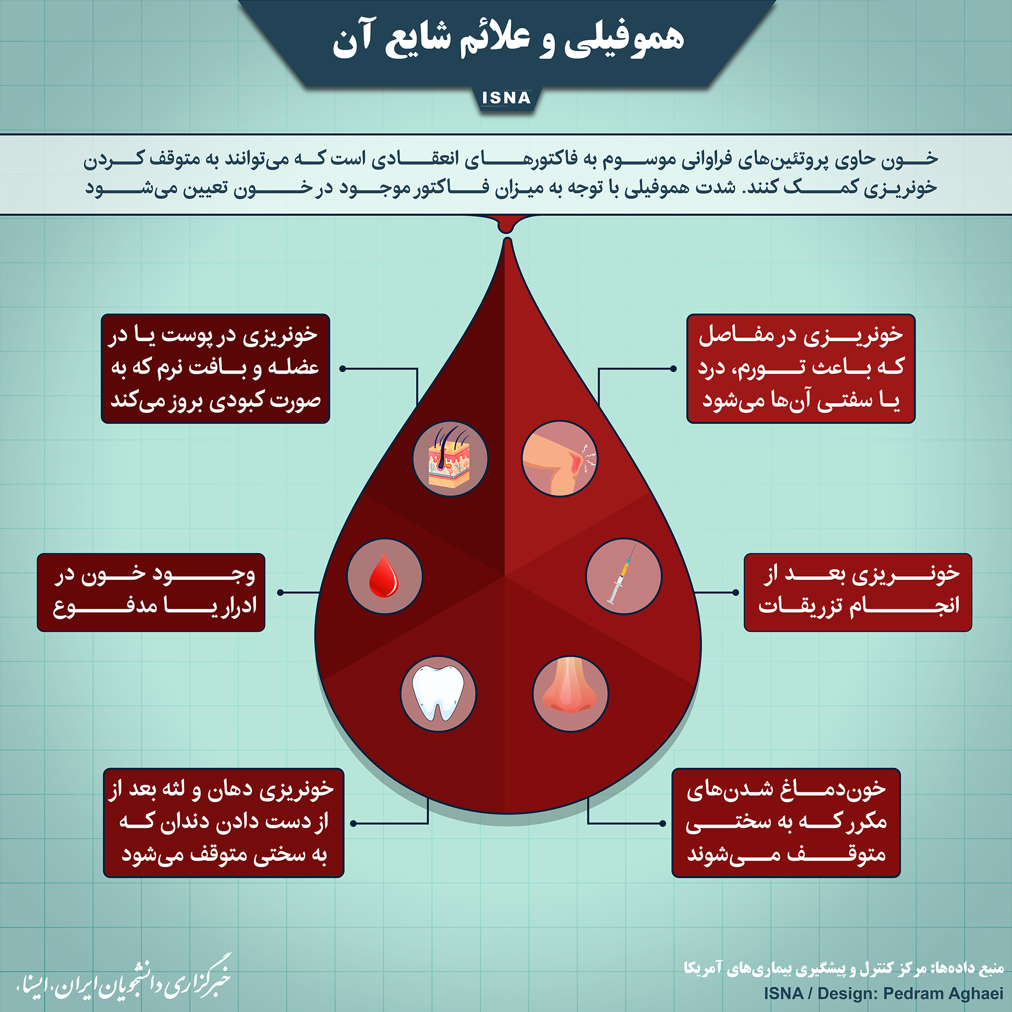 هموفیلی و علائم شایع آن