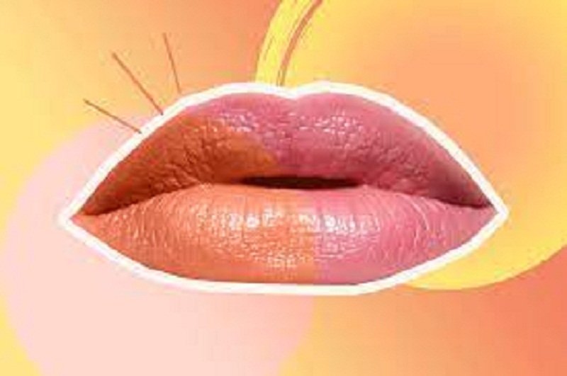 با لب‌های آفتاب‌سوخته چکار کنیم؟