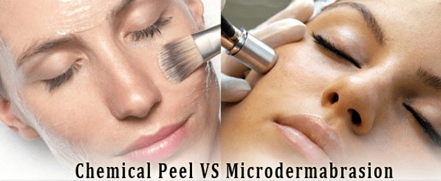 تفاوت میان لایه‌برداری شیمیایی و میکرودرم‌ابریژن