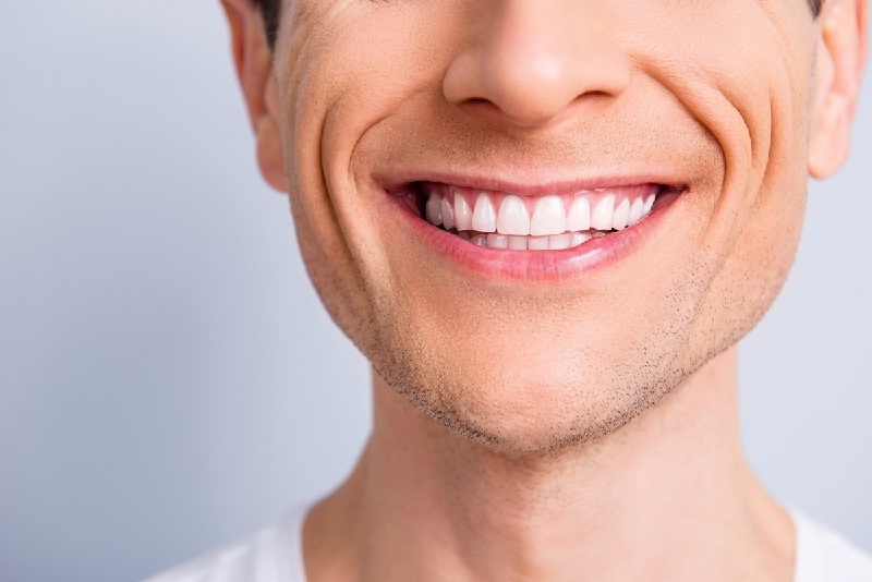 چگونه جلوه ظاهری بهتری به خطوط خنده بدهیم؟