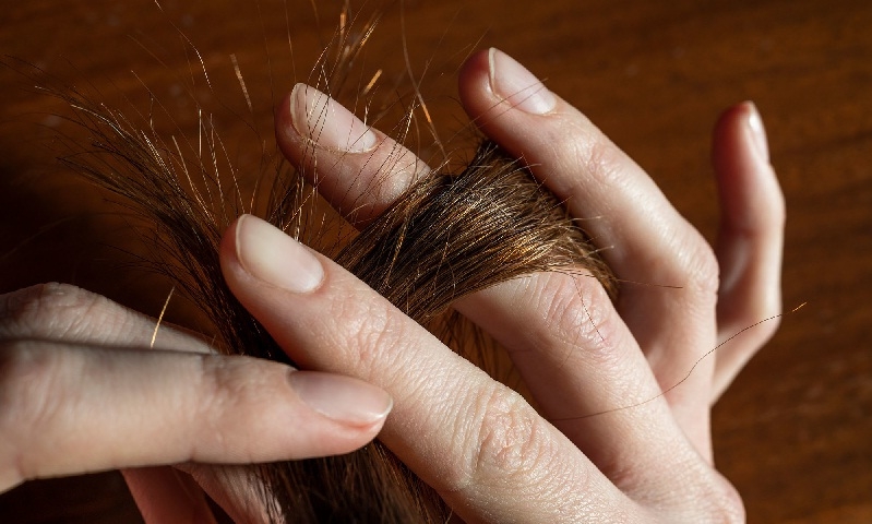 چگونه از مشکل موخوره پیشگیری کنیم؟